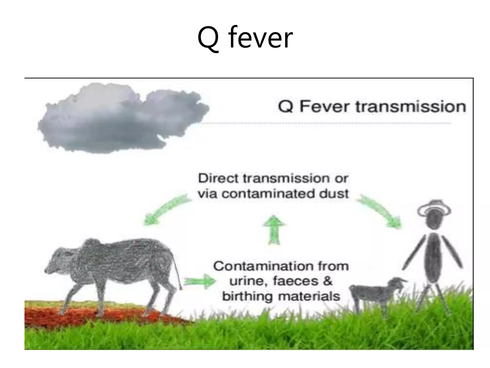 Q fever
 