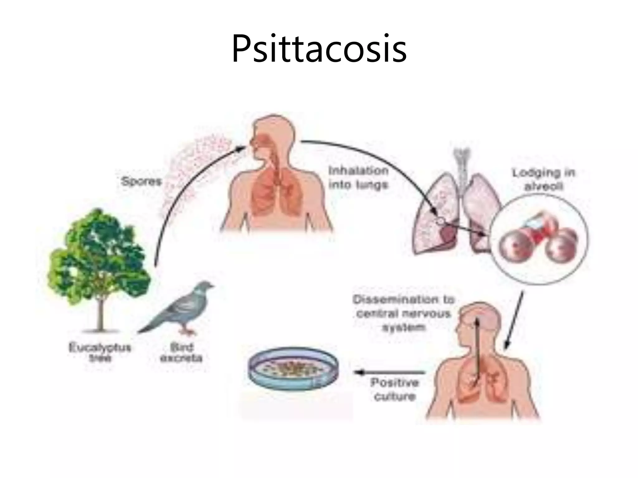 Psittacosis
 