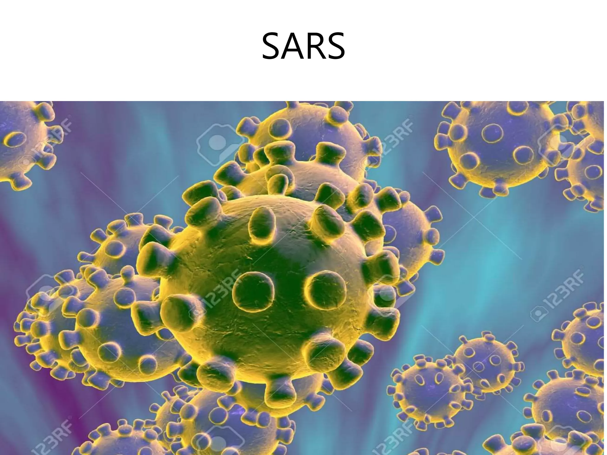 SARS
 
