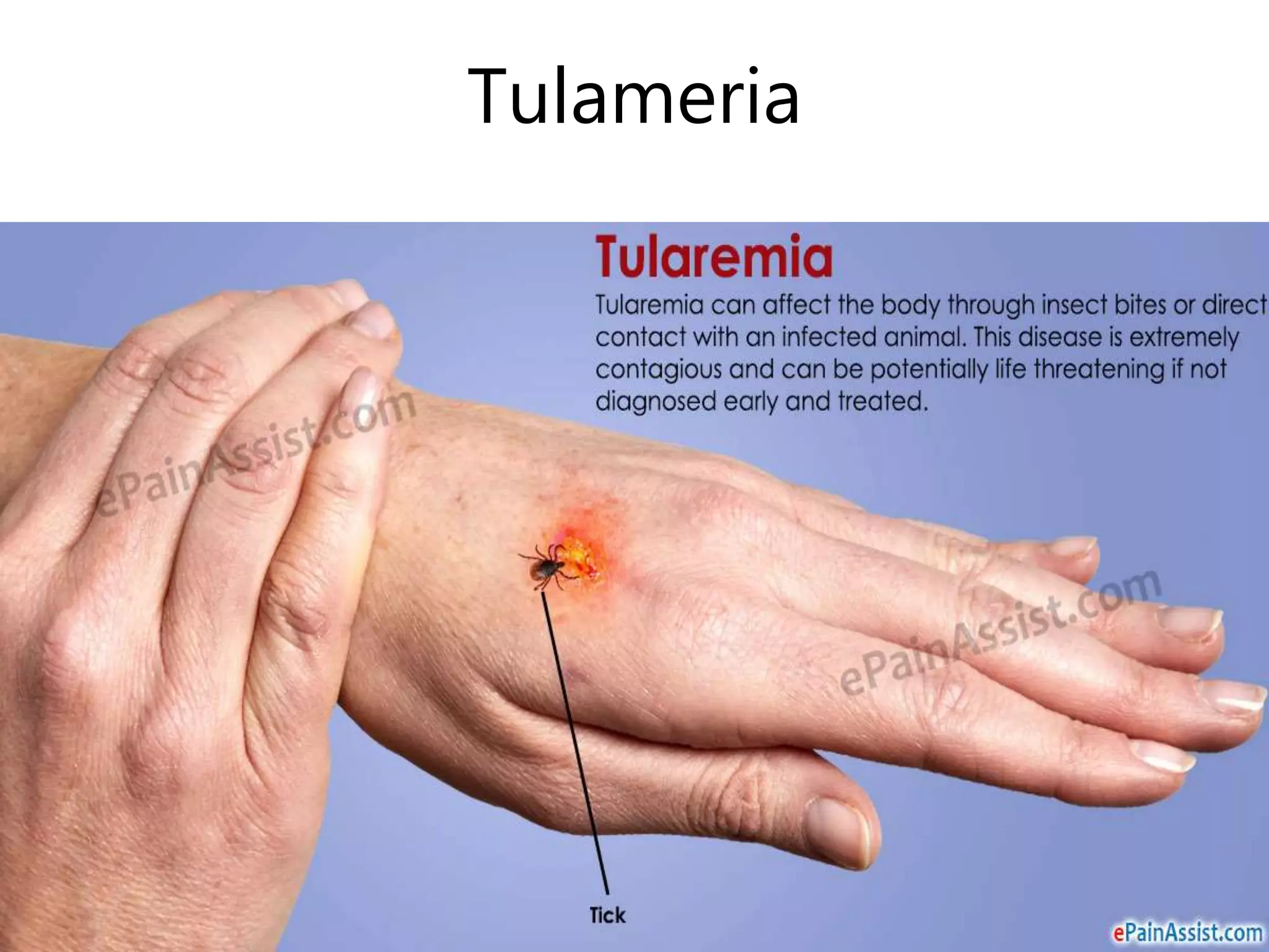 Tulameria
 