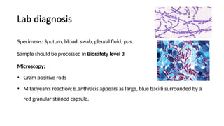 Biocrimmy Examples Bioterrorism : Biological agent :Biocrime | PPTX