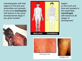 BIOTERRORISM and CLINICAL MEDICINE Presentation.ppt