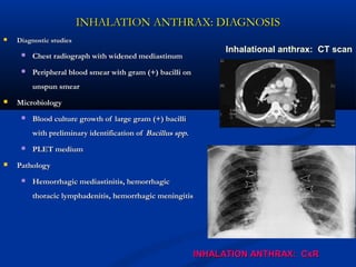INHALATION ANTHRAX: DIAGNOSISINHALATION ANTHRAX: DIAGNOSIS
 Diagnostic studiesDiagnostic studies
 Chest radiograph with widened mediastinumChest radiograph with widened mediastinum
 Peripheral blood smear with gram (+) bacilli onPeripheral blood smear with gram (+) bacilli on
unspun smearunspun smear
 MicrobiologyMicrobiology
 Blood culture growth of large gram (+) bacilliBlood culture growth of large gram (+) bacilli
with preliminary identification ofwith preliminary identification of Bacillus sppBacillus spp..
 PLET mediumPLET medium
 PathologyPathology
 Hemorrhagic mediastinitis, hemorrhagicHemorrhagic mediastinitis, hemorrhagic
thoracic lymphadenitis, hemorrhagic meningitisthoracic lymphadenitis, hemorrhagic meningitis
INHALATION ANTHRAX: CxRINHALATION ANTHRAX: CxR
Inhalational anthrax: CT scan
 