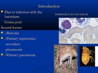 IntroductionIntroduction
 Due to infection with theDue to infection with the
bacteriumbacterium
Yersinia pestisYersinia pestis
Several forms:Several forms:
 ––BubonicBubonic
 ––Primary septicemia/Primary septicemia/
secondarysecondary
pneumonicpneumonic
 ––Primary pneumonicPrimary pneumonic
PERIPHERAL BLOOD SMEARPERIPHERAL BLOOD SMEAR
 