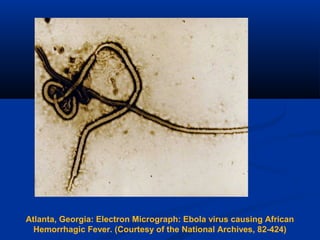 Atlanta, Georgia: Electron Micrograph: Ebola virus causing African
Hemorrhagic Fever. (Courtesy of the National Archives, 82-424)
 