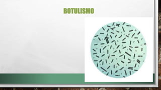 BOTULISMO
 