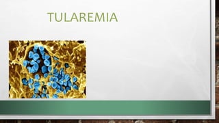 TULAREMIA
 