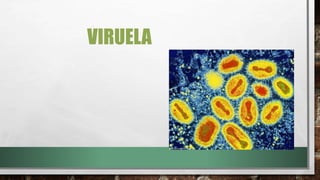 VIRUELA
 