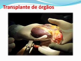 Transplante de órgãos
 