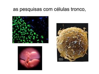 as pesquisas com células tronco,
 