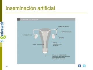 Inseminación artificial 