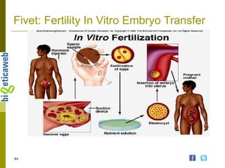 Fivet: Fertility In Vitro Embryo Transfer  