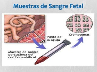 Muestras de Sangre Fetal
 