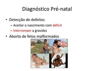 Diagnóstico Pré-natal
• Detecção de defeitos
– Aceitar o nascimento com déficit
– Interromper a gravidez

• Aborto de fetos malformados

 