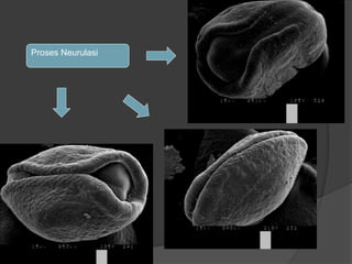 BIOUnnes_Gastrula & Neurula | PPTX