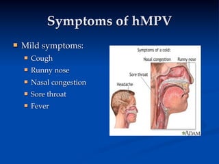 Symptoms of hMPV
   Mild symptoms:
       Cough
       Runny nose
       Nasal congestion
       Sore throat
       Fever
 