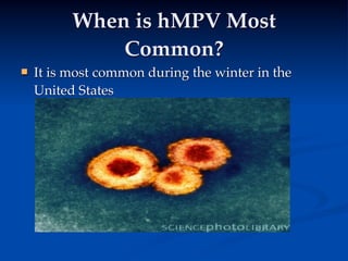 When is hMPV Most
              Common?
   It is most common during the winter in the
    United States
 