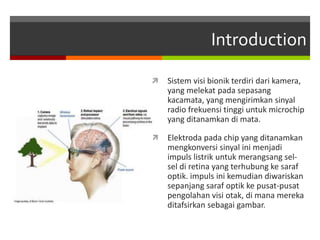 Introduction
 Sistem visi bionik terdiri dari kamera,
yang melekat pada sepasang
kacamata, yang mengirimkan sinyal
radio frekuensi tinggi untuk microchip
yang ditanamkan di mata.
 Elektroda pada chip yang ditanamkan
mengkonversi sinyal ini menjadi
impuls listrik untuk merangsang sel-
sel di retina yang terhubung ke saraf
optik. impuls ini kemudian diwariskan
sepanjang saraf optik ke pusat-pusat
pengolahan visi otak, di mana mereka
ditafsirkan sebagai gambar.
 