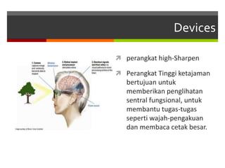 Devices
 perangkat high-Sharpen
 Perangkat Tinggi ketajaman
bertujuan untuk
memberikan penglihatan
sentral fungsional, untuk
membantu tugas-tugas
seperti wajah-pengakuan
dan membaca cetak besar.
 