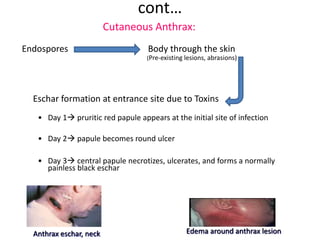 cont…
Cutaneous Anthrax:
Endospores Body through the skin
(Pre-existing lesions, abrasions)
Eschar formation at entrance site due to Toxins
• Day 1 pruritic red papule appears at the initial site of infection
• Day 2 papule becomes round ulcer
• Day 3 central papule necrotizes, ulcerates, and forms a normally
painless black eschar
Edema around anthrax lesionAnthrax eschar, neck
 