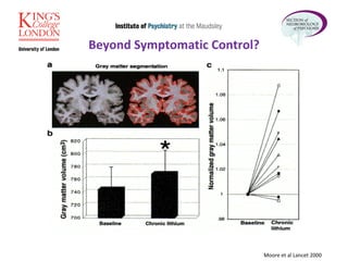 Beyond Symptomatic Control? Moore et al Lancet 2000 