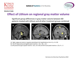Germana et al Acta Scan Psychiatrica 2010 Effect of Lithium on regional gray matter volume A B C Right subgenual anterior cingulate extending to the hypothalamus (ma x 4, y -4 z 10) B) Left hippocampus/amygdala (peak maxima x -16 y -28, z -12 ) C) Left postcentral gyrus (peak maxima x -30 y -24 z 64) and left insula (peak maxima x -32 y 4  z -2  Significant group differences in gray matter volume between BD  patients treated with Lithium and all other treatment groups combined 