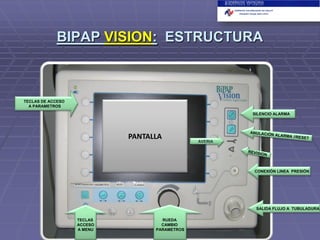 BIPAP VISION: ESTRUCTURA

TECLAS DE ACCESO
A PARAMETROS
SILENCIO ALARMA

PANTALLA

AVERIA

CONEXIÓN LINEA PRESIÓN

SALIDA FLUJO A TUBULADURA
TECLAS
ACCESO
A MENU

RUEDA
CAMBIO
PARAMETROS

 