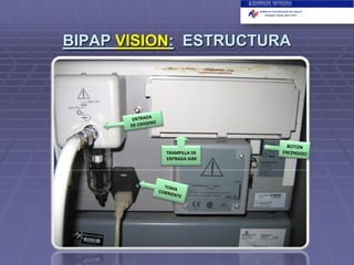 BIPAP VISION: ESTRUCTURA

TRAMPILLA DE
ENTRADA AIRE

 