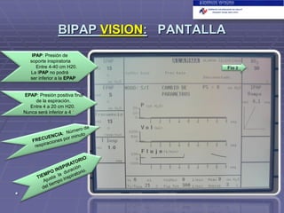 BIPAP VISION: PANTALLA
IPAP: Presión de
soporte inspiratoria
Entre 4-40 cm H20.
La IPAP no podrá
ser inferior a la EPAP

EPAP: Presión positiva final
de la espiración.
Entre 4 a 20 cm H20.
Nunca será inferior a 4 *



*

Fio 2

 