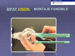 BIPAP VISION:

MONTAJE FUNGIBLE

VÁLVULA ESPIRATORIA: para evitar molestias
dirigirla en dirección contraria al paciente

CONEXIÓN TUBULADURA-INTERFASE

 