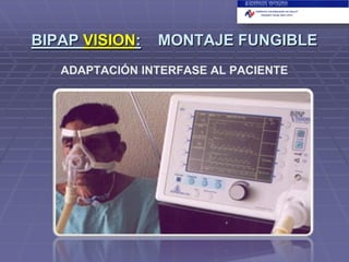 BIPAP VISION:

MONTAJE FUNGIBLE

ADAPTACIÓN INTERFASE AL PACIENTE

 