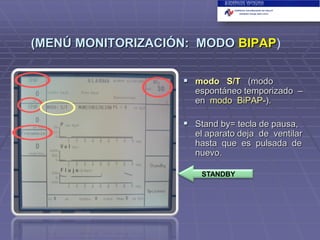 (MENÚ MONITORIZACIÓN: MODO BIPAP)
 modo S/T (modo

espontáneo temporizado –
en modo BiPAP-).

 Stand by= tecla de pausa,
el aparato deja de ventilar
hasta que es pulsada de
nuevo.
STANDBY

 
