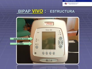 BIPAP VIVO

INDICADOR FUGAS
ALARMA

:

ESTRUCTURA

 