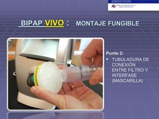 BIPAP VIVO

:

MONTAJE FUNGIBLE

Punto 2:
 TUBULADURA DE
CONEXIÓN
ENTRE FILTRO Y
INTERFASE
(MASCARILLA)

 