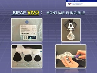 BIPAP VIVO

:

MONTAJE FUNGIBLE

 