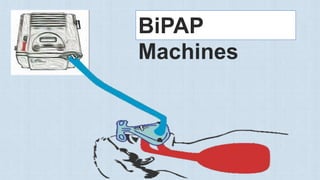 BiPAP
Machines
 