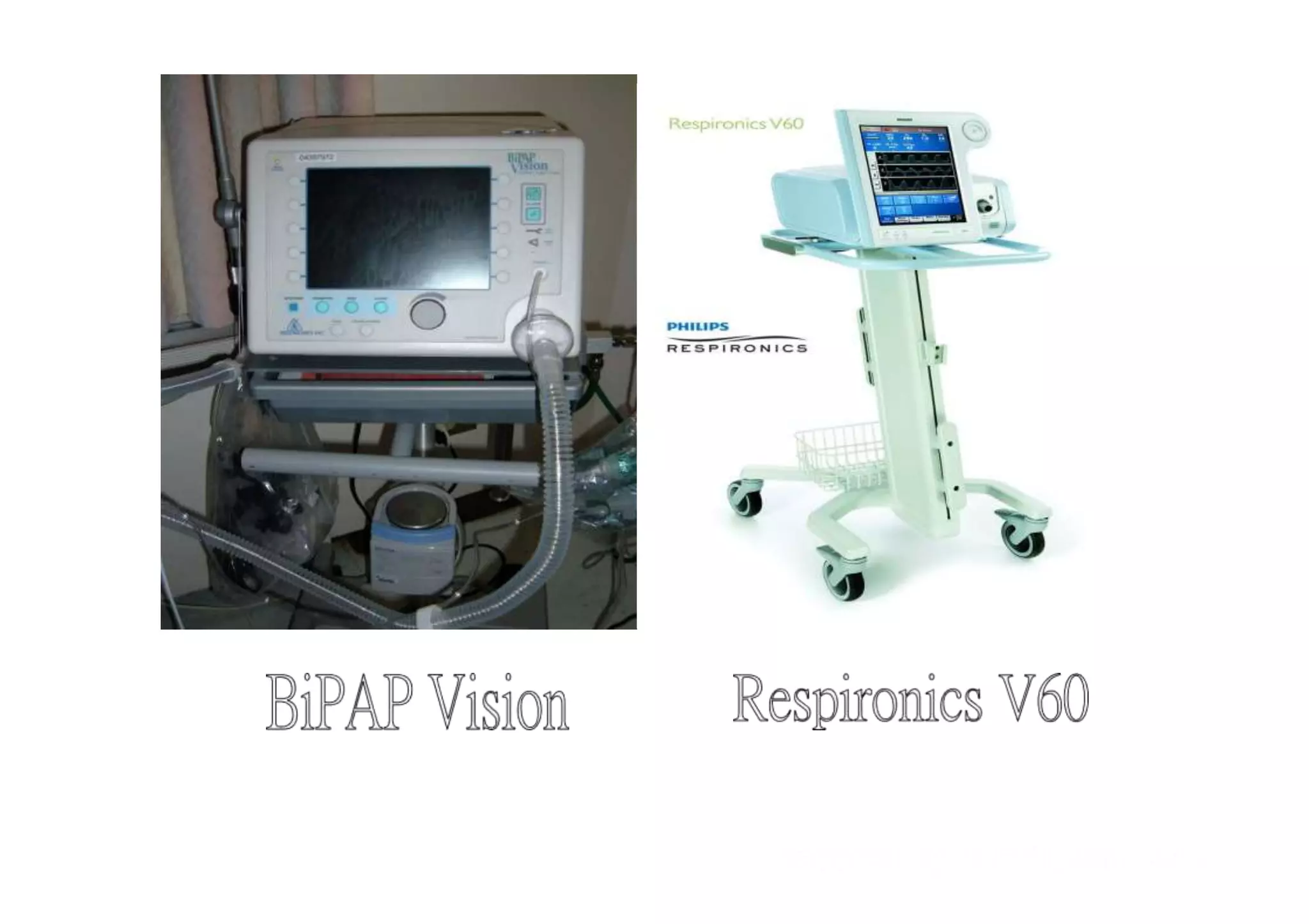 Bi pap -ppt | PPTX
