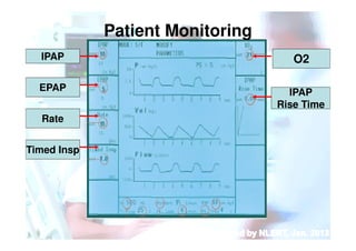 BiPAP_many.pdf
