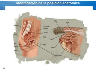 Modificación de la posición anatómica




Page  54
 