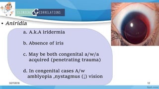 Real Anatomy of UVEA. | PPTX
