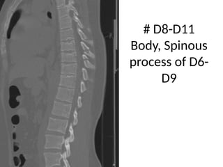 A Unique Case of Polytrauma - Learning opportunity | PPTX
