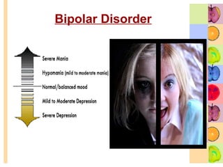 Bipolar Disorder 
