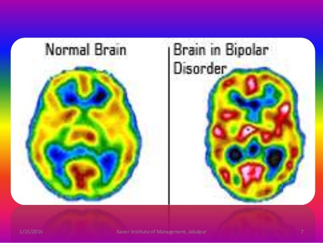 strattera bipolar ii disorder