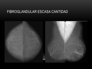 FIBROGLANDULAR ESCASA CANTIDAD
 