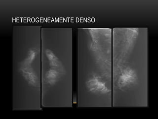 HETEROGENEAMENTE DENSO
 