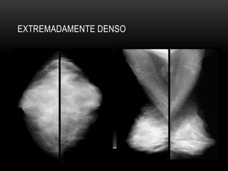 EXTREMADAMENTE DENSO
 