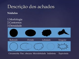 Descrição dos achadosDescrição dos achados
Nódulos
1.Morfologia
2.Contornos
3.Densidade
Redondo Ovóide Lobulado Irregular
Circunscrita Parc. obscura Microlobulada Indistinta Espiculada
 