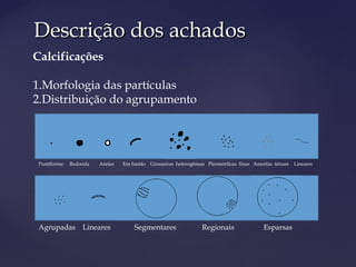 Descrição dos achadosDescrição dos achados
Calcificações
1.Morfologia das partículas
2.Distribuição do agrupamento
Puntiforme Redonda Anelar Em bastão Grosseiras heterogêneas Pleomórficas finas Amorfas tênues Lineares
Agrupadas Lineares Segmentares Regionais Esparsas
 