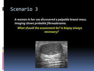Scenario 3
A woman in her 20s discovered a palpable breast mass.
Imaging shows probable fibroadenoma.
What should the assessment be? Is biopsy always
necessary?
 