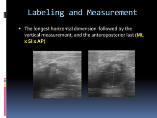 Labeling and Measurement
 The longest horizontal dimension followed by the
vertical measurement, and the anteroposterior last (ML
x SI x AP)
 